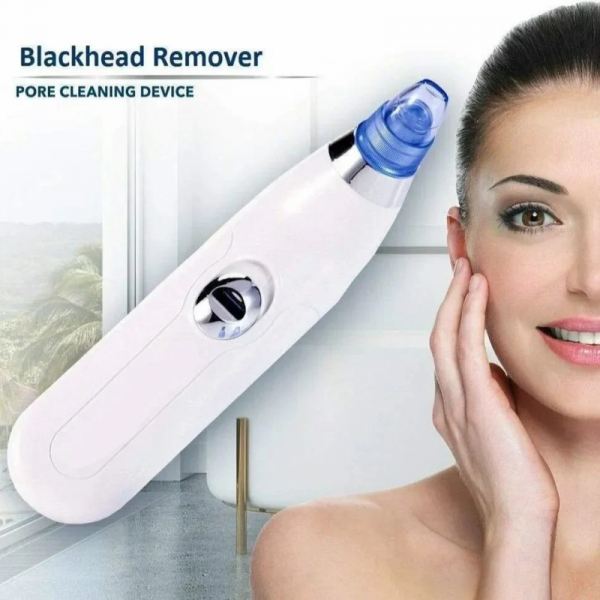 Blackhead Remover Pore Vacuum - DermaSuction