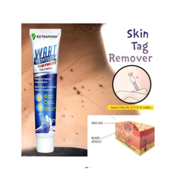Wart Removal Ointement - Extraposh