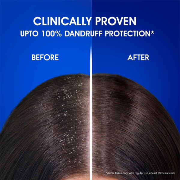 Anti Dandruff Shampoo - Head & Shoulders
