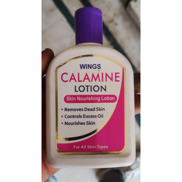 Calamine Lotion - Wings