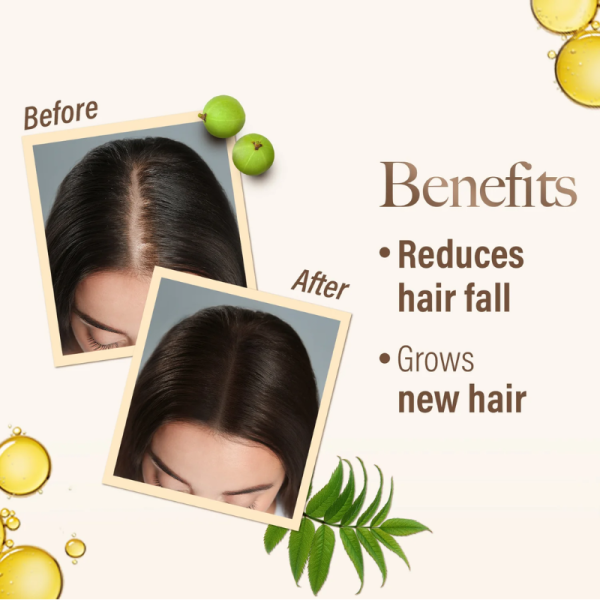 Hair Oil - Kesh King